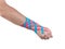 Tex tape therapeutic treatment of the wrist.