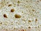 The texture of closeup white bread. A pattern of holes is visible