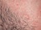 Texture of irritated reddened male neck skin covered with hair and bristles