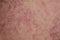 Texture of irritated reddened male neck skin covered with hair and bristles