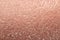 Texture of the unhealthy human skin epidermis with flaky and cr