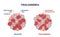 Thalassemia blood disorder caused by lack of hemoglobin outline diagram