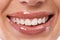 Thats a perfect smile. a womans mouth and teeth.