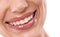 Thats a perfect smile. a womans mouth and teeth.