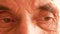 Theme of ophthalmology for the elderly. Close-up of the eyes of a pensioner with poor vision. Tired look of a Caucasian man extrem