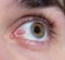 There is reddened the eye of a young guy, a programmer