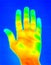 Thermograph-Hand Palm