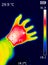 Thermographic image of a person`s hand showing different temperatures in different colors, from blue indicating cold to red