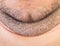 Thick double chin with stubble on the face. Aesthetic defect, chin correction exercises. Macro