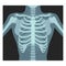 Thorax x-ray. Lungs radiological control. Radiography of chest, ribs., torso. Fluorography.