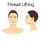 Thread lifting, vector illustration, face of a girl