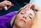 Threading hair removal procedure