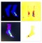 Three phase bone scan active inflammation