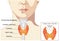 Thyroid anatomy (including throat, protective gland, and trachea).