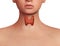 Thyroid cancer. development of cancer in the thyroid gland in the human body. 3D rendering