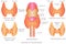 Thyroid gland