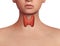 Thyroid gland exposed on the neck of a woman with endocrine disruption, inflammation and swelling. Endocrine system disease