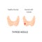 Thyroid gland vector