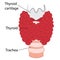 Thyroid healthy and enlarged thyroid. hypothyroid vector illustration