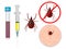 Tick-borne encephalitis vaccination.Tick bite protection Vaccination against ticks. Prevention of infections transmitted