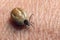 A tick drunk on blood crawls on human skin