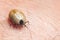 A tick drunk on blood crawls on human skin