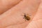 Tick filled with blood crawling on human body skin