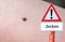 Ticks Warning sign with a tick on the arm in german