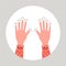 Tingling and numbness in the hands. Finger sensitivity problem. Flat vector illustration