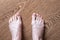 Tired barefoot female legs with protruding veins on a wooden background, top view. Foot health problems