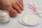 Toenail affected by a fungus with cream in a jar, cotton pads and cotton buds.