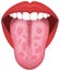 Tongueâ€™s health sign vector illustration  Geographic Tongue