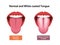 Tongueâ€™s health sign vector illustration  White coated tongue