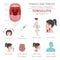 Tonsils and throat diseases. Tonsillitis symptoms, treatment icon set. Medical infographic design