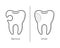 Tooth before and after caries