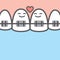 Tooth character couple upper illustration vector on blue background. Dental concept.