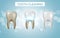 Tooth clean 3d health. Dental realistic dirty whitening. Dentist teeth hygiene isolated medicine template