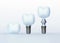 Tooth Crown and Tooth Implants