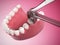 Tooth extraction