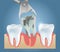 Tooth extraction vector medical poster design template