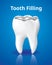 Tooth Filling, Dental care concept, Realistic design illustration Vector