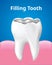 Tooth Filling with gum Dental care concept, Realistic design Vector