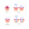 Tooth filling and implant chart. Vector biomedical illustration. Cross section. Filled teeth and prosthesis implantation steps