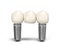 Tooth human bridge implant Dental concept Human teeth or dentures  multitooth 3d render on white