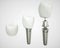 Tooth implant disassembled - (3d rendering)