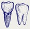 Tooth implant and molar