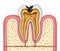 Tooth inner anatomy of a cavity