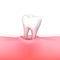 Tooth loss on white background.