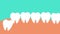 Tooth pushing from the inside and giving pain to the gum 4K animation. Dangerous wisdom toothache causes gum pain footage. A