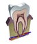Tooth section, cutting, dentist, gum, dentistry